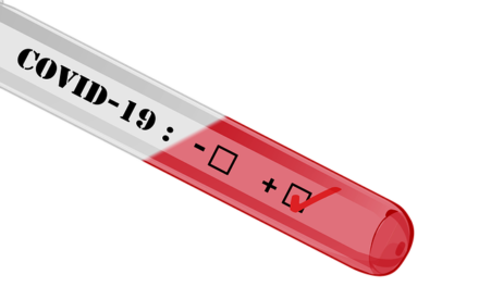 Pruebas diagnósticas para Covid-19